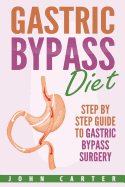 Gastric Bypass Diet: Step By Step Guide to Gastric Bypass Surgery