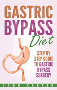 Gastric Bypass Diet: Step by Step Guide to Gastric Bypass Surgery
