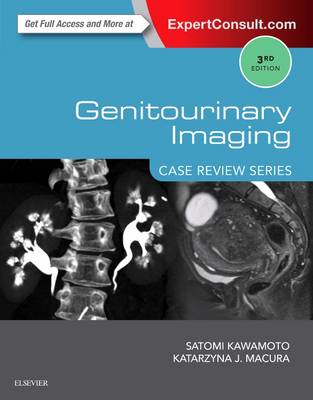 Genitourinary Imaging: Case Review - Kawamoto, Satomi, and Macura, Katarzyna J, MD, PhD, FACR