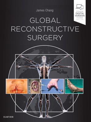 Global Reconstructive Surgery - Chang, James, MD