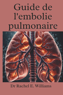 Guide de l'embolie pulmonaire