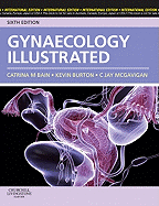 Gynaecology Illustrated