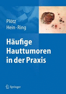 Hufige Hauttumoren in Der Praxis