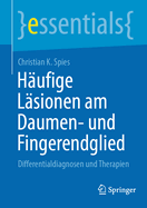 Hufige Lsionen am Daumen- und Fingerendglied: Differentialdiagnosen und Therapien