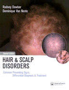 Hair and Scalp Disorders: Common Presenting Signs, Differential Diagnosis
