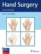 Hand Surgery: Tricks of the Trade