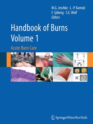 Handbook of Burns, Volume 1: Acute Burn Care - Jeschke, Marc G (Editor), and Kamolz, Lars-Peter (Editor), and Sjberg, Folke (Editor)