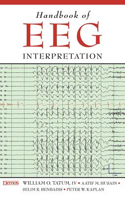 Handbook Of Eeg Interpretation By William Tatum, Do - Alibris