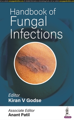 Handbook of Fungal Infections - Godse, Kiran V, and Patil, Anant
