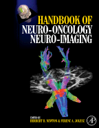 Handbook of Neuro-Oncology Neuroimaging - Jolesz, Ferenc A, and Newton, Herbert B (Editor)