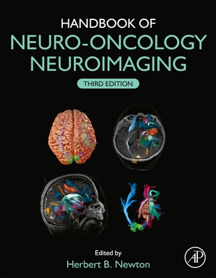Handbook of Neuro-Oncology Neuroimaging - Newton, Herbert B (Editor)