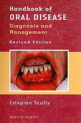 Handbook of Oral Disease: Diagnosis and Management - Scully, Crispian, Dean, MD, PhD (Editor)