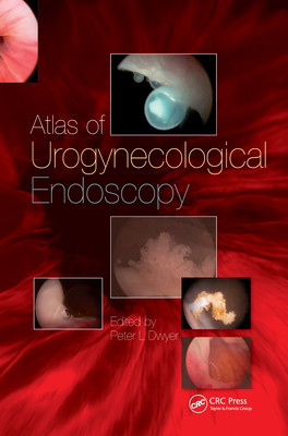 Handbook of Urologic Cryoablation - Rukstalis, Daniel (Editor), and Katz, Aaron E, MD (Editor)