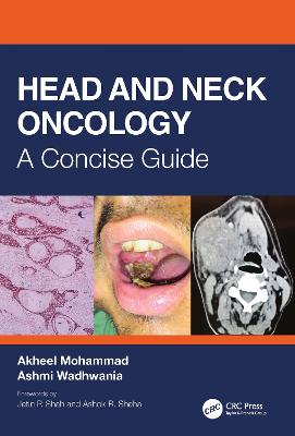 Head and Neck Oncology: A Concise Guide - Mohammad, Akheel, and Wadhwania, Ashmi