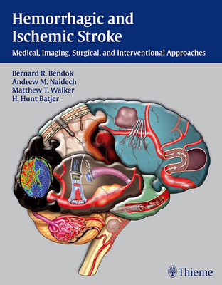 Hemorrhagic and Ischemic Stroke: Medical, Imaging, Surgical and Interventional Approaches - Bendok, Bernard (Editor), and Naidech, Andrew M (Editor), and Walker, Matthew T (Editor)