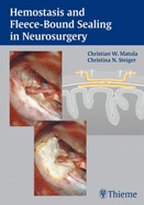 Hemostasis and Fleece-Bound Sealing in Neurosurgery - Matula, Christian, and Steiger, Christina