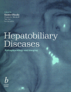 Hepatobiliary Diseases: Pathophysiology and Imaging - Okuda, Kunio (Editor), and Mitchell, Donald G (Editor), and Itai, Yuji (Editor)