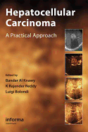 Hepatocellular Carcinoma: A Practical Approach