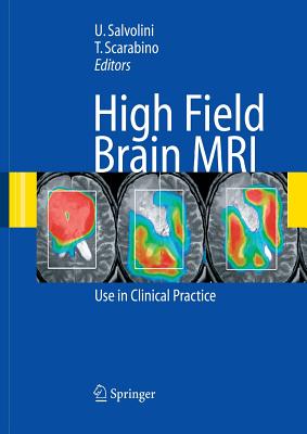 High Field Brain MRI: Use in Clinical Practice - Salvolini, Ugo (Editor), and Scarabino, T. (Editor)