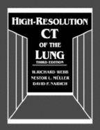 High-Resolution CT of the Lung - Webb, W Richard, M.D., and Muller, Nestor L, MD, PhD, and Naidich, David P, MD