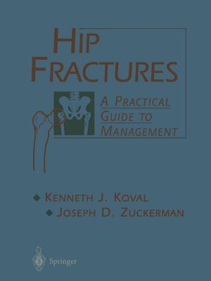 Hip Fractures: A Practical Guide to Management - Koval, Kenneth, and Rockwood, C a Jr (Foreword by), and Zuckerman, Joseph, MD