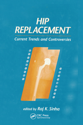 Hip Replacement: Current Trends and Controversies - Sinha, Raj K.