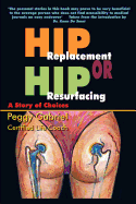 Hip Replacement or Hip Resurfacing: A Story of Choices