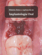 Histor?a Cl?nica Y Exploraci?n En Implantolog?a Oral