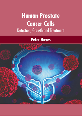 Human Prostate Cancer Cells: Detection, Growth and Treatment - Hayes, Peter (Editor)