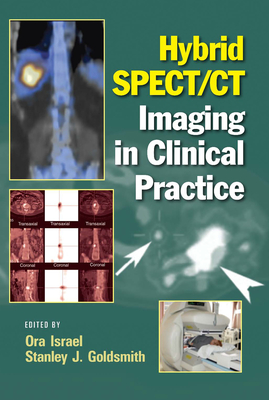 Hybrid SPECT/CT Imaging in Clinical Practice - Israel, Ora (Editor), and Goldsmith, Stanley J (Editor)