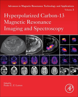 Hyperpolarized Carbon-13 Magnetic Resonance Imaging and Spectroscopy - Larson, Peder (Editor)