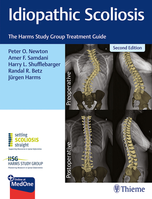 Idiopathic Scoliosis: The Harms Study Group Treatment Guide - Newton, Peter (Editor), and Samdani, Amer (Editor), and Shufflebarger, Harry (Editor)