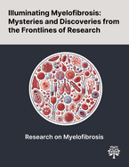 Illuminating Myelofibrosis: Mysteries and Discoveries From the Frontlines of Research