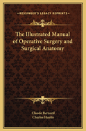 Illustrated manual of operative surgery and surgical anatomy