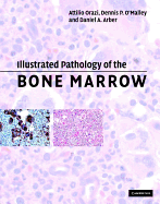 Illustrated Pathology of the Bone Marrow