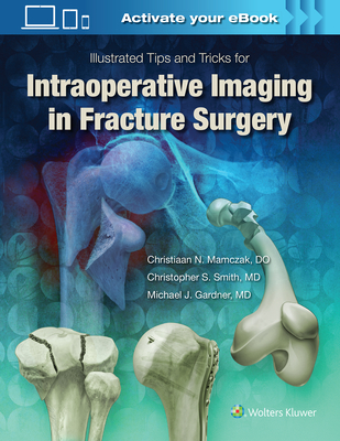 Illustrated Tips and Tricks for Intraoperative Imaging in Fracture Surgery - Gardner, Michael J, Dr., MD