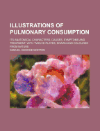 Illustrations of Pulmonary Consumption: Its Anatomical Characters, Causes, Symptoms and Treatment. with Twelve Plates, Drawn and Coloured from Nature