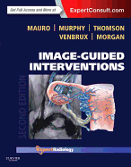 Image-Guided Interventions: Expert Radiology Series (Expert Consult - Online and Print)