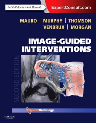Image-Guided Interventions: Expert Radiology Series (Expert Consult - Online and Print) - Mauro, Matthew A, and Murphy, Kieran P J, MB, Frcpc, and Thomson, Kenneth R, MD