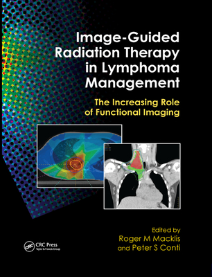 Image-Guided Radiation Therapy in Lymphoma Management: The Increasing Role of Functional Imaging - Macklis, Roger M. (Editor), and Conti, Peter S. (Editor)