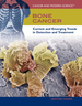 Bone Cancer