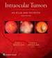 Intraocular Tumors: an Atlas and Textbook