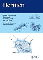 Hernien [Gebundene Ausgabe] Von Volker Schumpelick, Georg Arlt, Klaus Joachim Conze, Karsten Junge (Autoren)