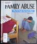 Family Abuse: Why Do People Hur (Issues of Our Time (21st Century Books))