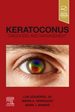 Keratoconus, 1st Edition