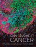 Case Studies in Cancer, First Edition