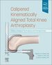 Calipered Kinematically Aligned Total Knee Arthroplasty, 1st Edition