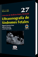 Ultrasonograf'a De S'Ndromes Fetales (27) ColecciN De Medic