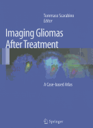 Imaging Gliomas After Treatment: A Case-based Atlas