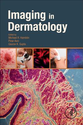 Imaging in Dermatology - Hamblin, Michael R. (Editor), and Avci, Pinar (Editor), and Gupta, Gaurav K (Editor)